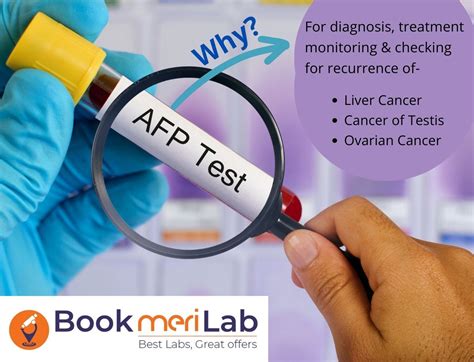 Afp Tumor Marker Test Price Purpose Results And Range 2024