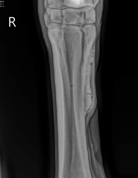 Digital Radiology - Barwon Equine Hospital