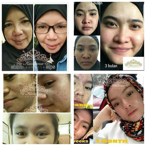 Jadi, kalau produk yang anda cari terdapat di dalam senarai ini, bermakna produk tersebut mempunyai kelulusan kkm. Karisma Cosmetic Stokis Cik Puteh 0182375690: WOW ...