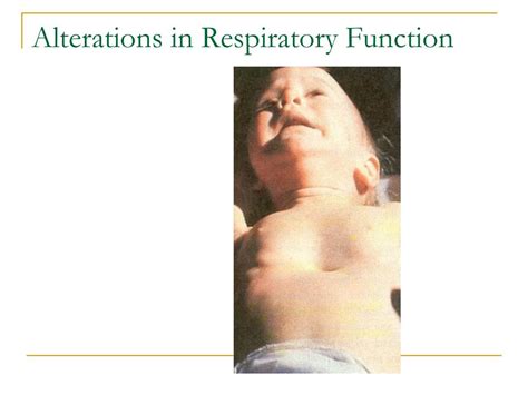 Ppt Respiratory Assessment Powerpoint Presentation Free Download