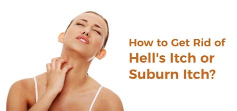 Hells Itch Sunburn Itch Causes Natural Treatments And Prevention