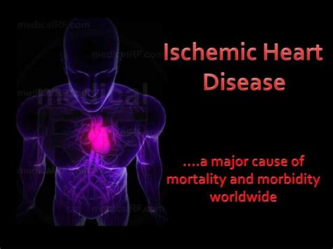 Ppt Ischemic Heart Disease Powerpoint Presentation Free Download Id 2730580