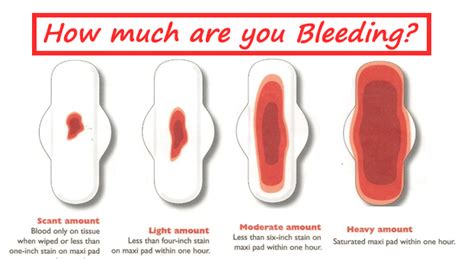 Is It Normal To Have Blood Clots During Your Period
