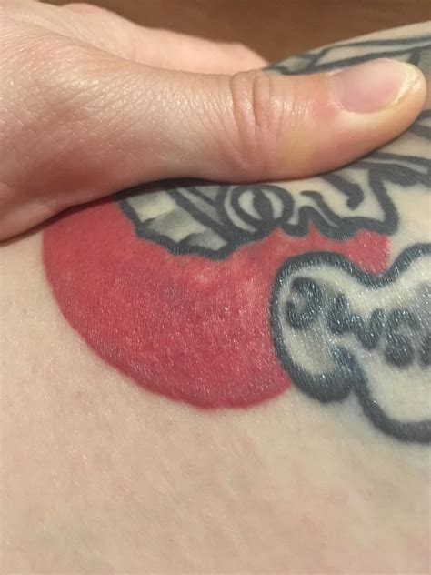 White Bumps On Tattoo What Does It Mean And How To Treat It Tattify