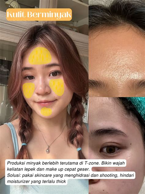 TANDA SKINCARE KAMU GA COCOK‼️stop pemakaian😱⚠️ | Galeri diposting oleh
