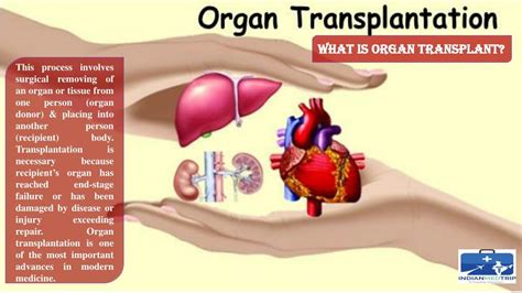 Ppt What Is Organ Transplant Powerpoint Presentation Free Download