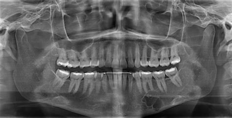 Com March 2011 Diagnosis Uw School Of Dentistry