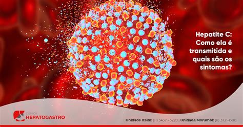 Hepatite C Sintomas Na Pele