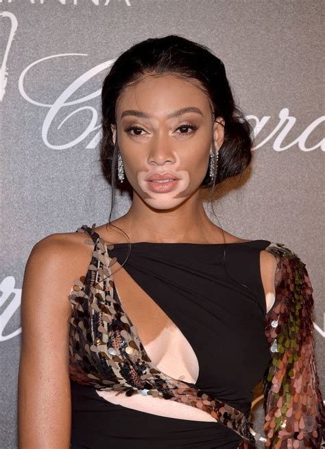 Winnie Harlow Wore A Fall 2017 Dress To The Dinner