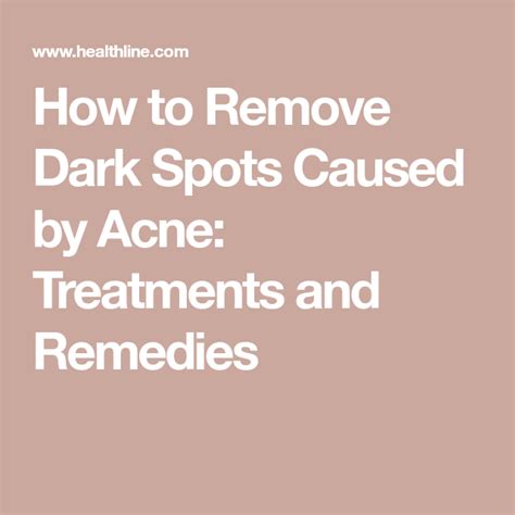 How To Remove Dark Spots Caused By Acne Treatments And Remedies