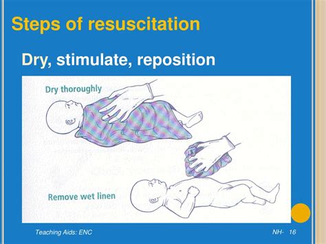 Ppt Resuscitation Of The Newborn Baby Powerpoint Presentation Free