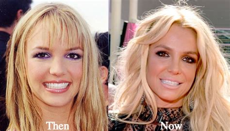 Britney spears age, height, affairs and much more. Celebrities Who've Had So Much Plastic Surgery, They Look Like a Different Person