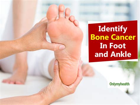 Symptoms Of Bone Cancer In Foot And Ankle My XXX Hot Girl