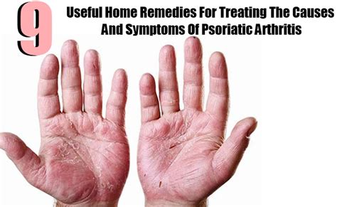 9 Useful Home Remedies For Treating The Causes And Symptoms Of