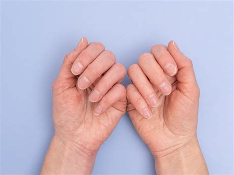 Bruzdy na paznokciach mogą oznaczać poważne choroby Nie lekceważ ich