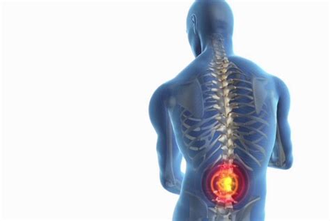Tanezumab Safe And Effective In The Treatment Of Chronic Lower Back
