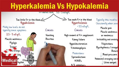 Hyperkalemia And Hypokalemia Causes Sign And Symptoms And Treatments