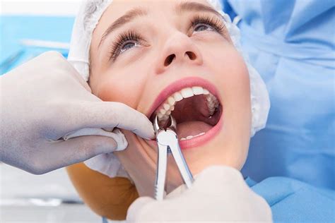 Tooth Extractions in West New York