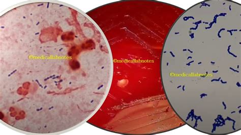 And Viridans Streptococci In Gram Staining Of Culture Right Archives Medical Notes