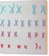 Down S Syndrome Karyotype Photograph By Kateryna Kon Science Photo