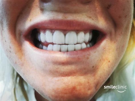 Its Time To Smile From Ear To Ear Dental Holiday Smile Dental