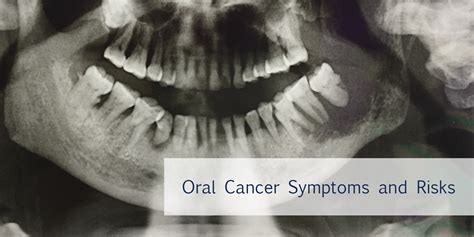 Oral Cancer Symptoms And Risks Carewell Urgent Care