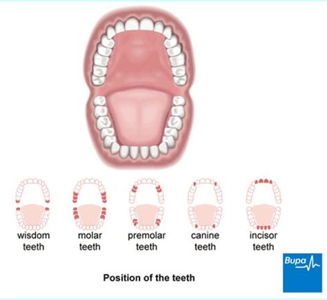Wisdom tooth pain is just no fun. Wisdom Teeth Pain Relief | Wisdom Teeth | Pinterest