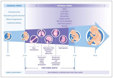 Preterm Birth Risk Factor For Early Onset Chronic Diseases Cmaj