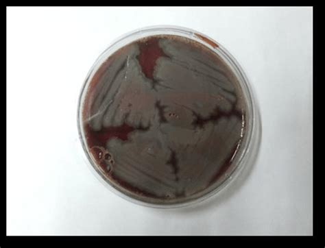 Growth Of Bacillus Spp On Blood Agar Medium Download Scientific Diagram