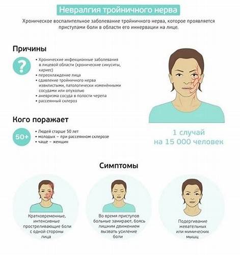 Диета лицевого неврита Доклад: Лечение невралгии тройничного нерва — Хелп Диплом Доклад: Лечение невралгии тройничного нерва — Хелп Диплом Диета лицевого неврита