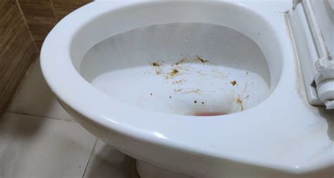 How To Clean Poop Stains From Toilet Bowl Livingproofmag