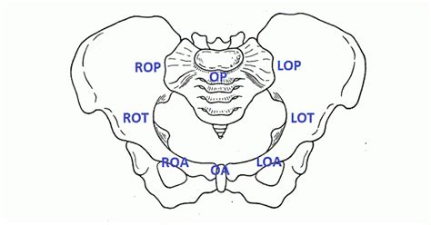 Occiput Posterior Position Op