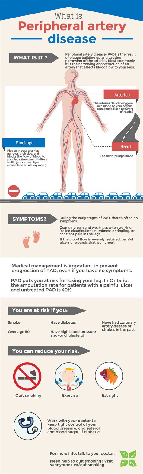 Are Your Legs Safe More About Peripheral Artery Disease