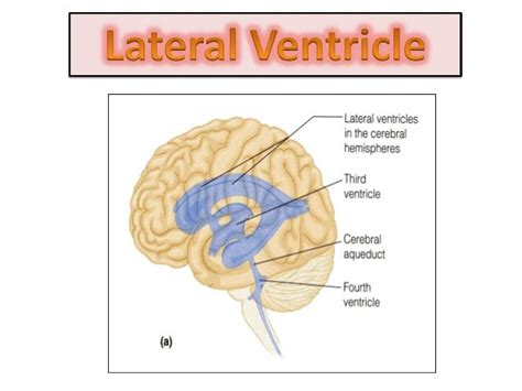 Parts Of Lateral Ventricle