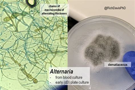 Alternaria Colony