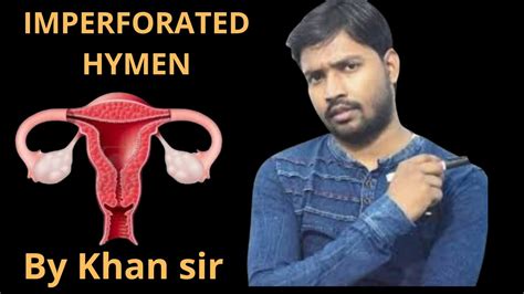 Imperforated Hymen Perforated Hymenhymen Examvirgin Hymen Hymen Youtube
