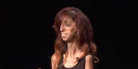 Labeled 'World's Ugliest Woman,' Motivational Speaker Turns Hate Into ...
