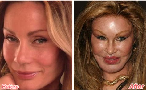 16 Shocking Celebrity Before And After Transformations Page 11 Of 16