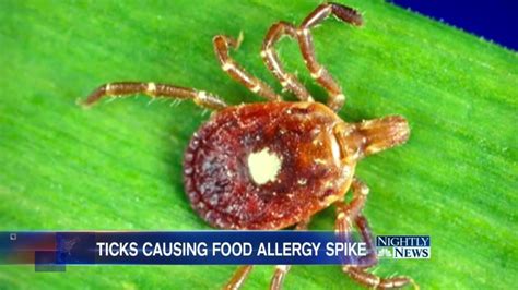 Tick Bite Linked To Rise In Red Meat Allergies Why Now Nbc News