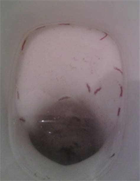 Get Rid Of Worm In Toilet Transportrutracker