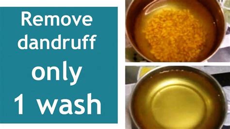 You could also mix it with your shampoo and use it to wash your hair. How to Remove Dandruff Permanently in 1 Wash! # ...