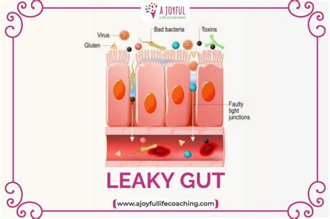Top 10 Alarming Symptoms Of Leaky Gut And Blood In Stool