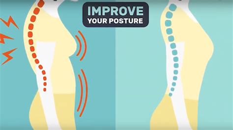 Aoa Orthopedic Specialists How To Improve Your Posture Easy