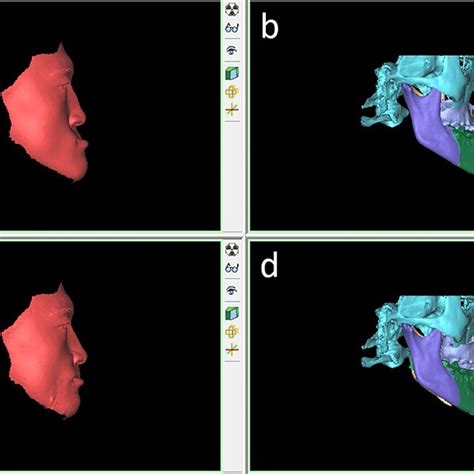fusion of predicted and actual 3d facial images a registration of the download scientific