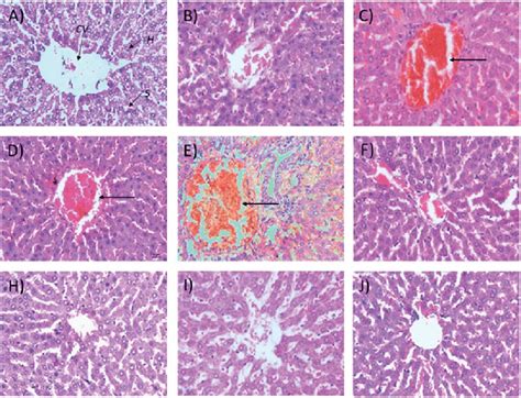 Histological Structures Of Liver Samples After 28 Days Of Treatment