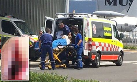 Nsw Man Has Angle Grinder Blade Lodged In His Skull