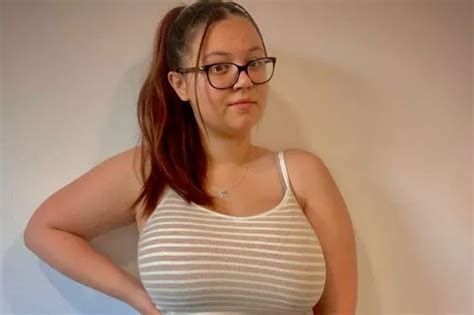 Student With 32k Breasts Told To Lose Three Stone If She Wants Surgery