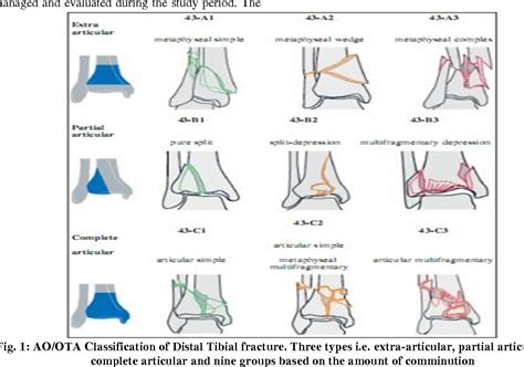 Distal Tibia Fracture Classification