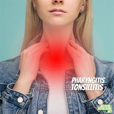 Pharyngitis And Tonsillitis Diagnosis And Treatment At Home