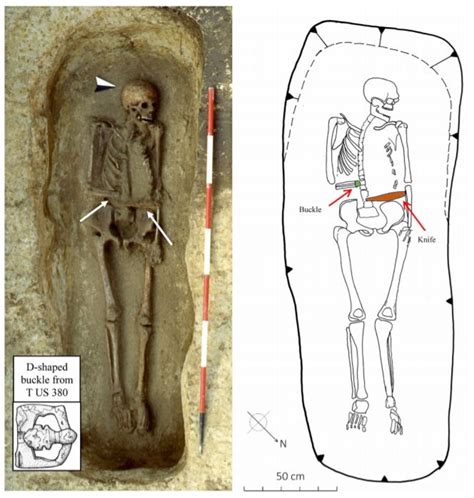 Medieval Skeleton Found With Possible Arm Prosthesis Archaeology Magazine